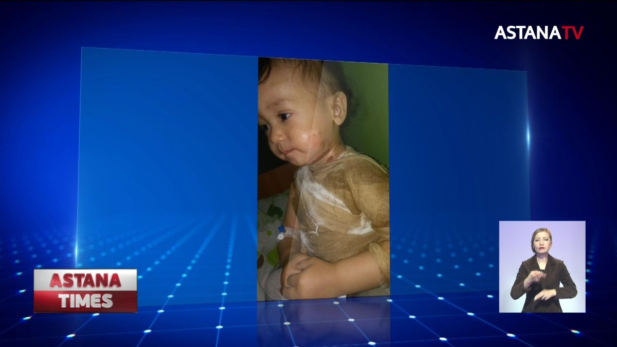 Ребенка с ожогами лечили зубной пастой в поезде: мать требует наказать проводников