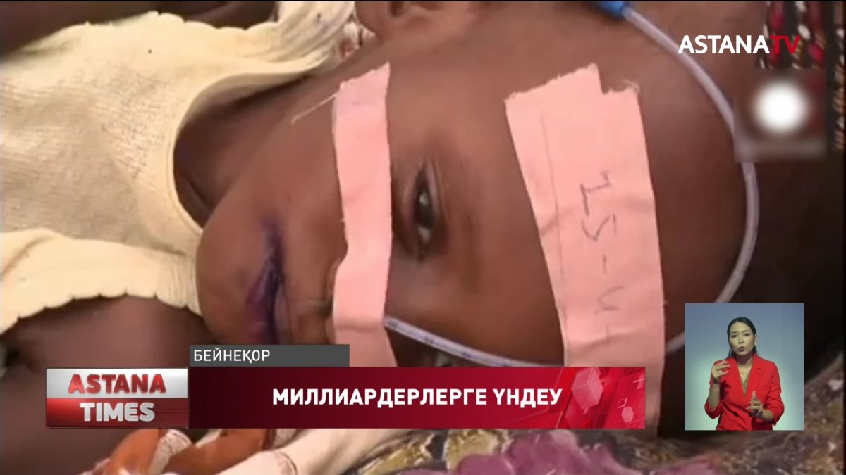 БҰҰ әлемдегі аштықпен күресуге байларды шақырды