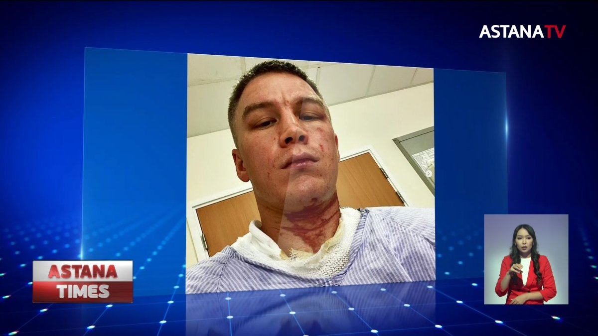 Казахстанского боксера облили кислотой на сборах в Великобритании