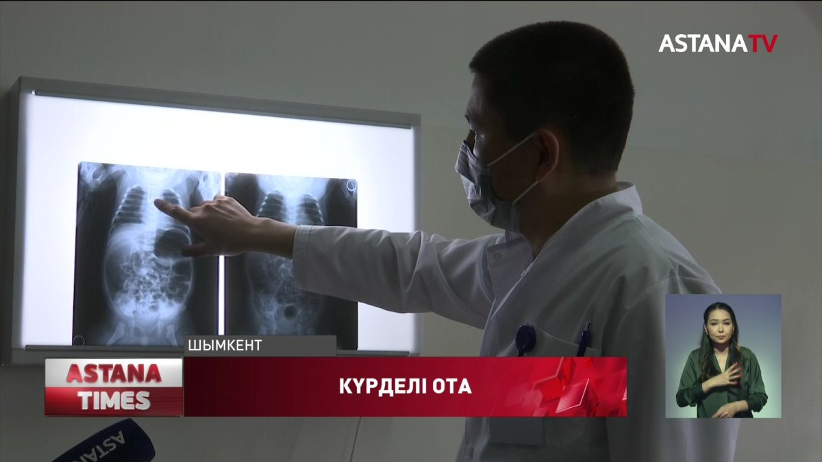 Дәрігерлер нәрестенің тыныс жолынан түйреуіш алып шықты