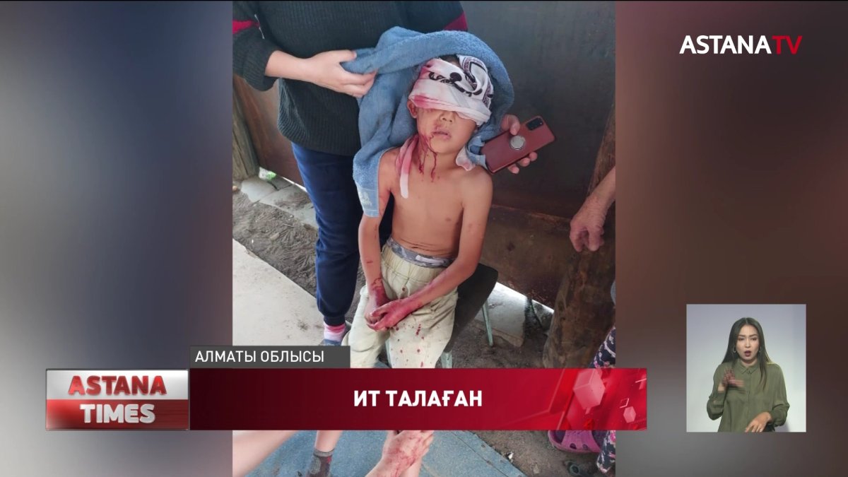 Алматы облысында оқушыны ит талаған