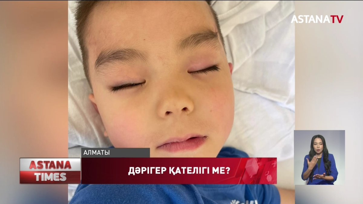 Алматыда дәрігер операцияны баланың оң көзіне  жасаудың орнына, сол көзіне жасаған