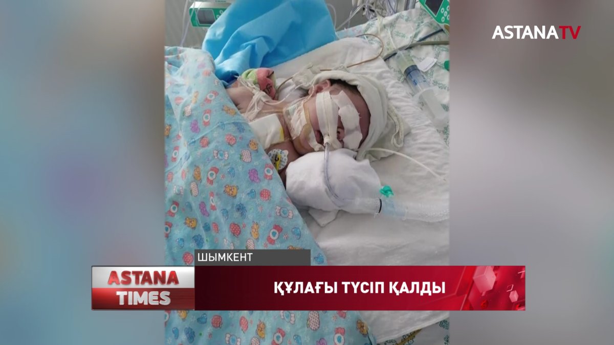 Түркістан облысында 4 айлық баланың құлағы түсіп қалды
