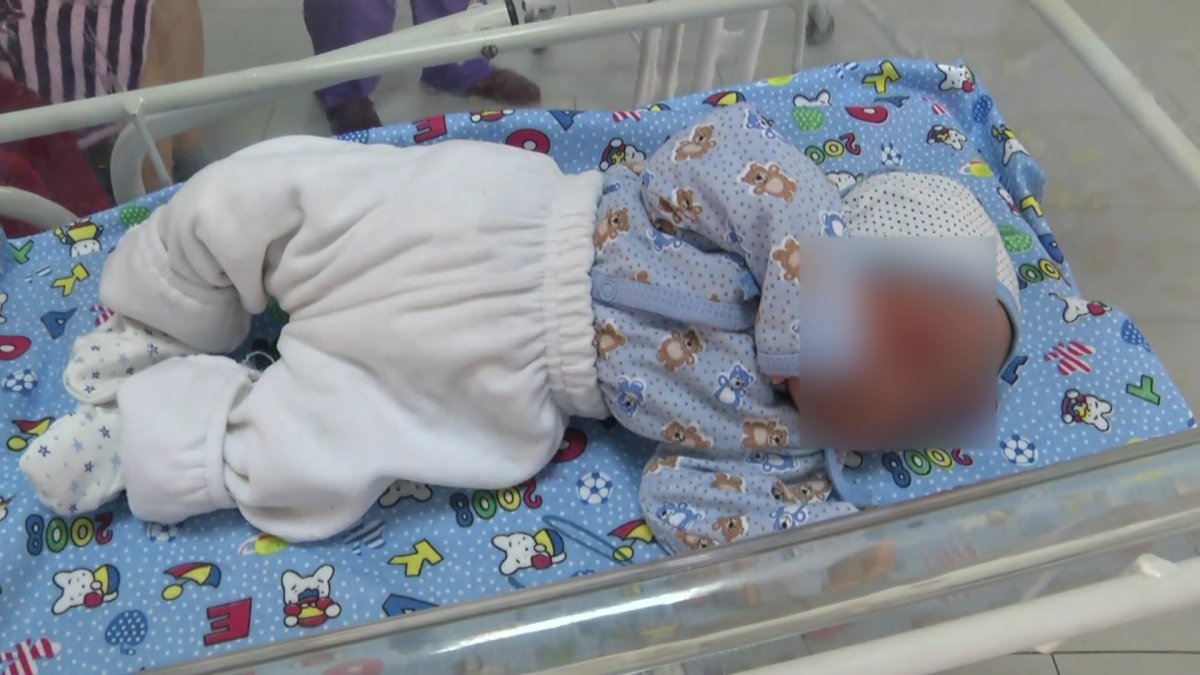 Генетикалық мутацияның салдарынан мүмкіндігі шектеулі балалар саны артты