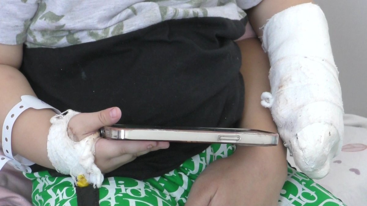 Сырғанақта ойнаймын деп саусағынан айырыла жаздады