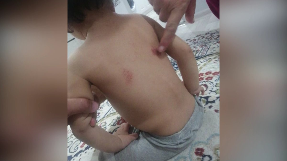 Ақтөбеде жеке балабақша тәрбиеленушілерінің үсті-басы көгеріп келген