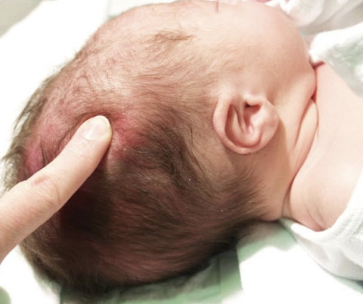 Отец избил шестимесячного сына: у ребенка перелом черепа