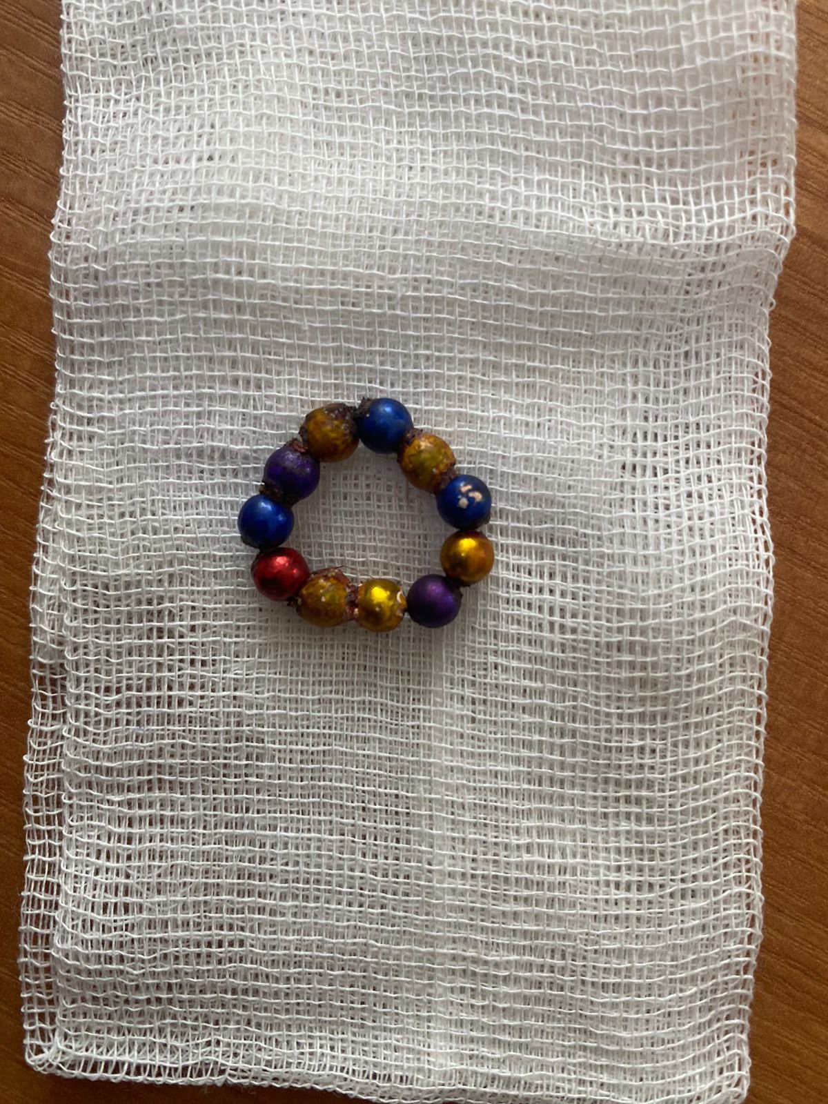 Қарағандылық дәрігерлер бірнеше магнит жұтып қойған баланың өмірін сақтап қалды