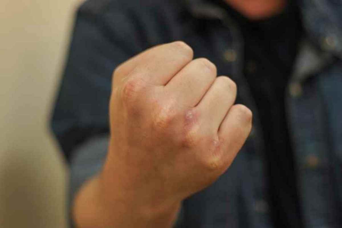 Ұлытау облысында кеніш қызметкерін сабаған күдіктілердің кім екені анықталды