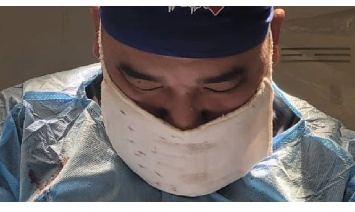 Сложную операцию на черепе провели упавшему с лошади жанаозенцу