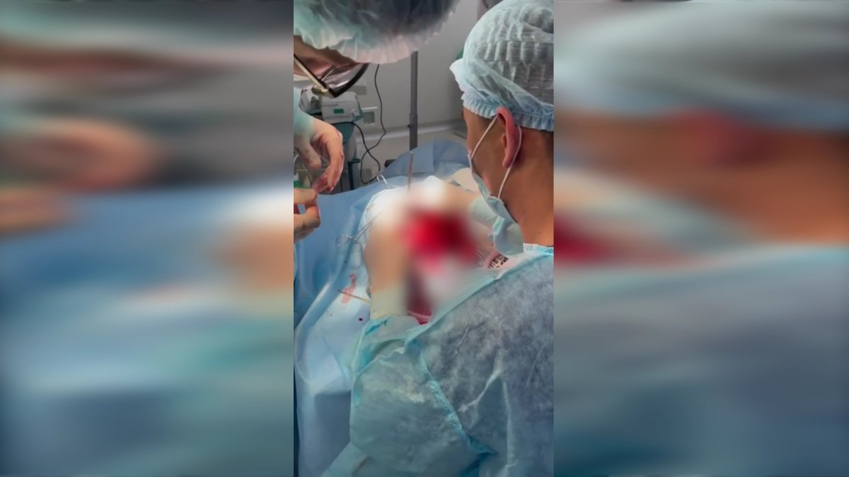 Шымкенттік дәрігерлер 10 жастағы баланың миынан бір уыс құрт алып шықты