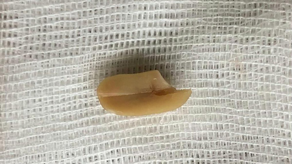 "Жержаңғақ-өте қауіпті"