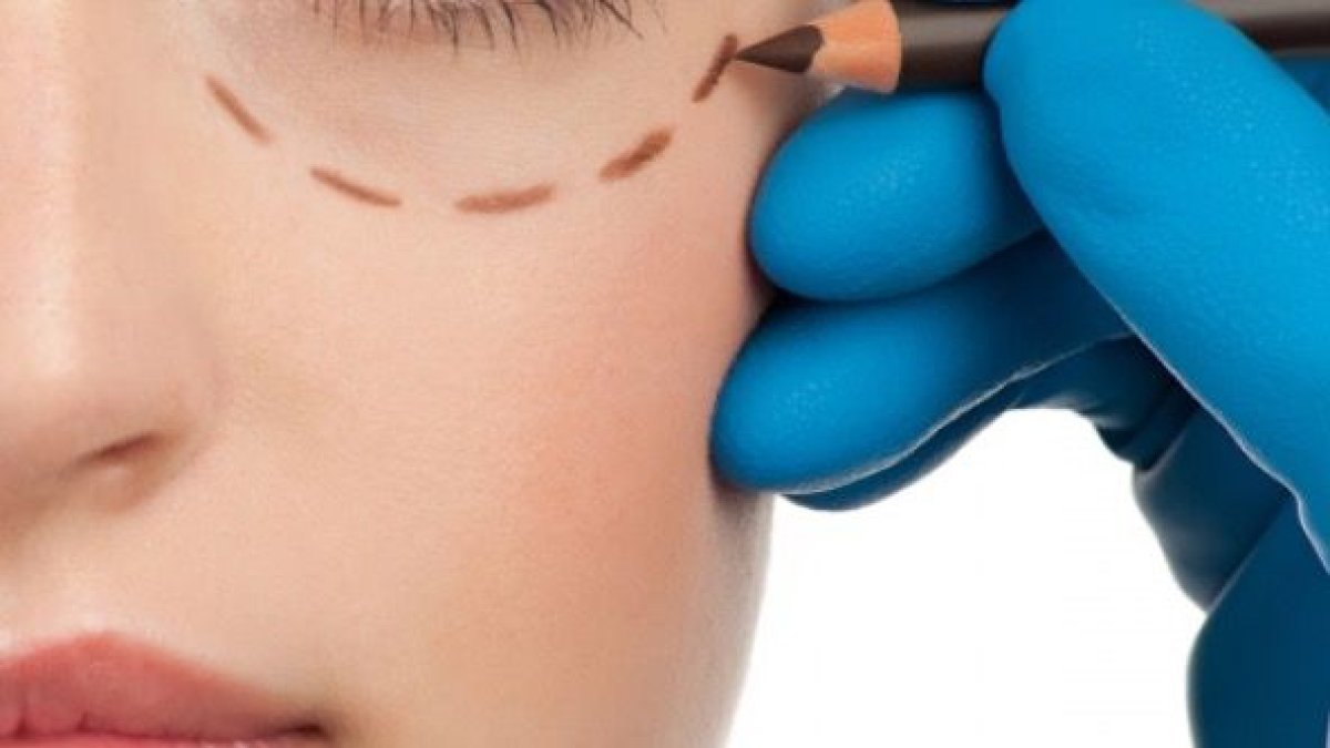 Өскеменде сұлулық салонына блефаропластика жасатуға барған әйел көз жұмды