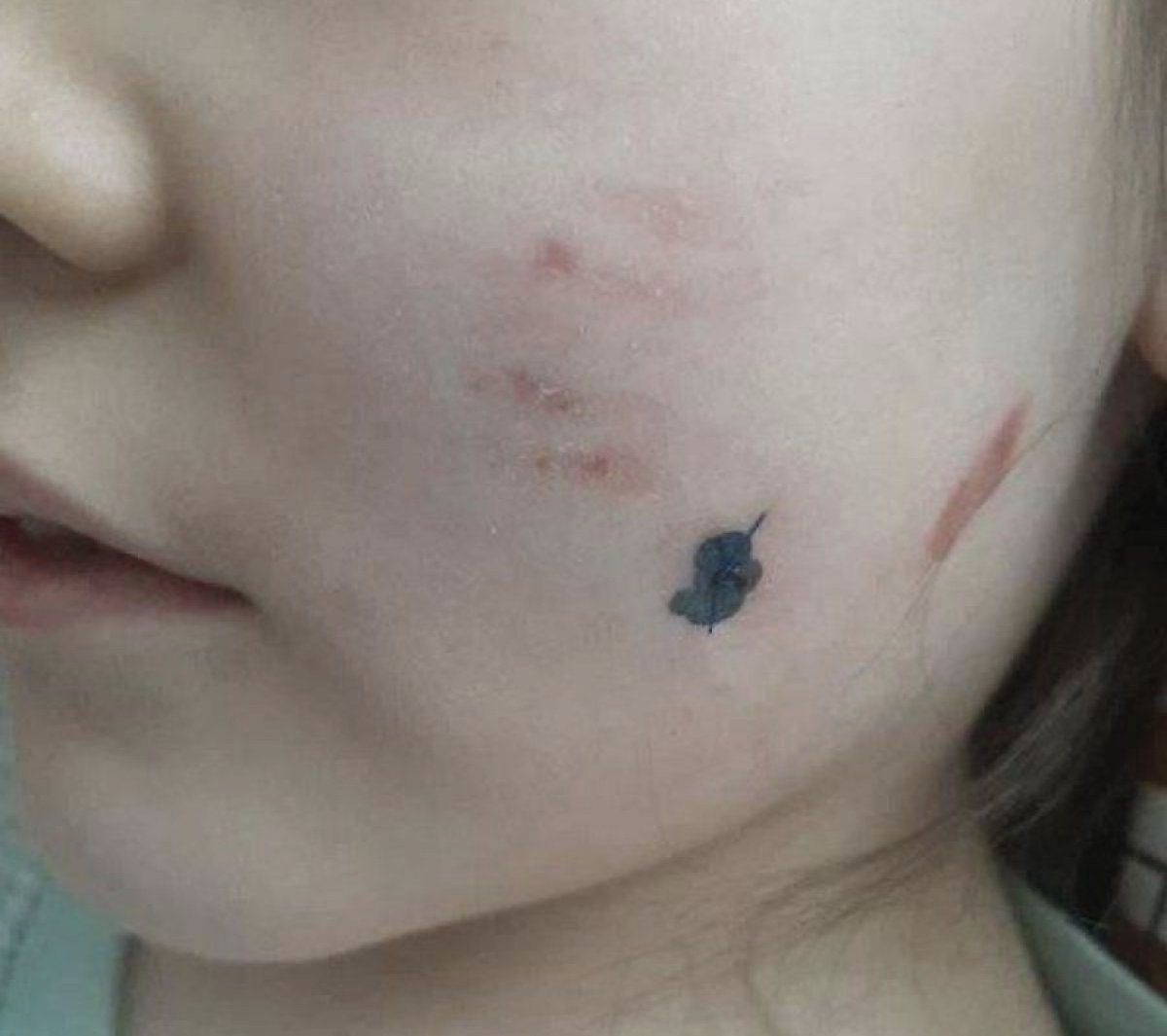 Стая бродячих собак напала на 8-летнюю девочку в Семее