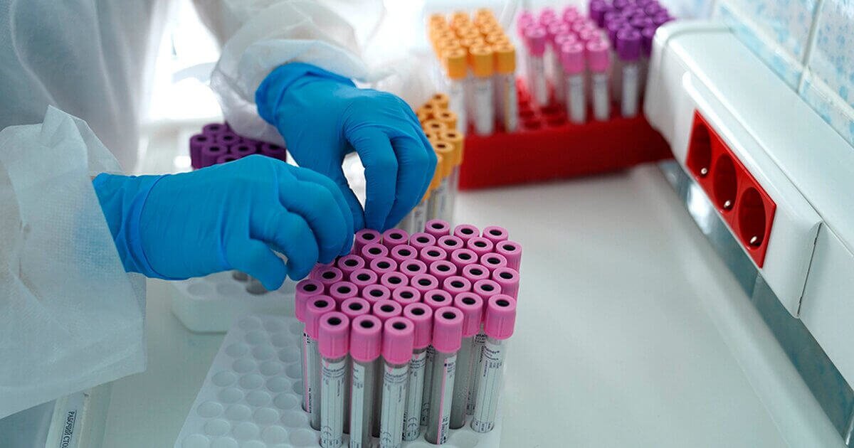 Елімізде өткен тәулікте 73 адамнан коронавирус анықталды – ДСМ