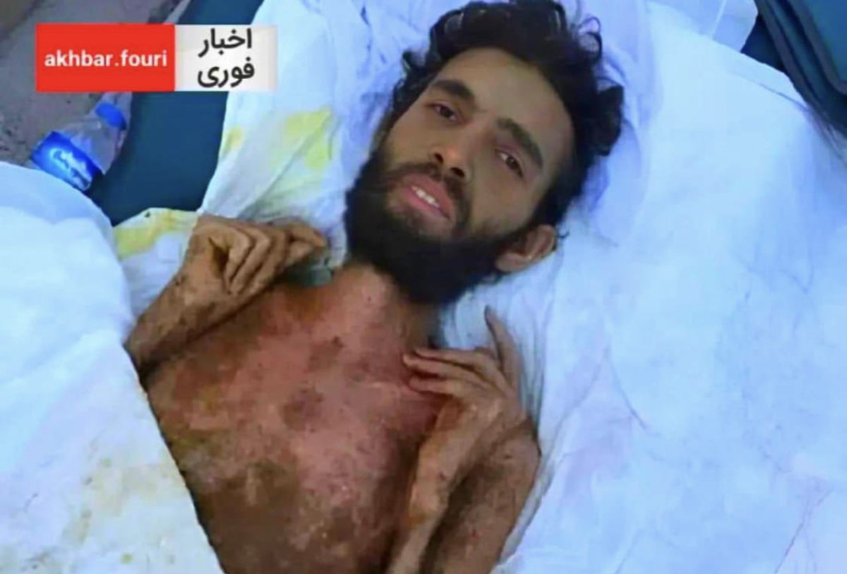 Три месяца под завалами в Сирии: журналисты заявили о фейке