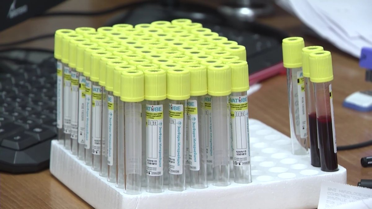 Заболеваемость ВИЧ в Казахстане выросла в два раза