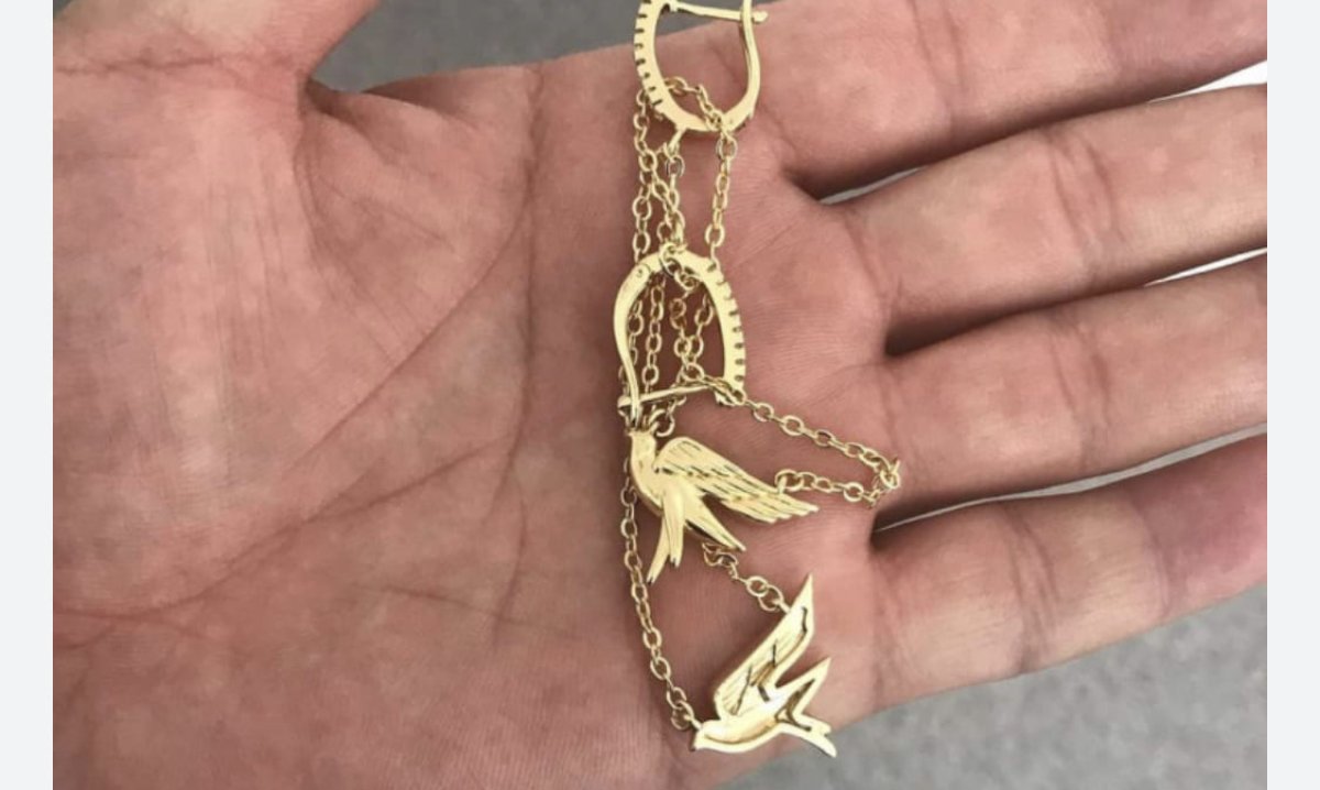 Золотой браслет и сережки извлекли из желудка маленького кызылординца