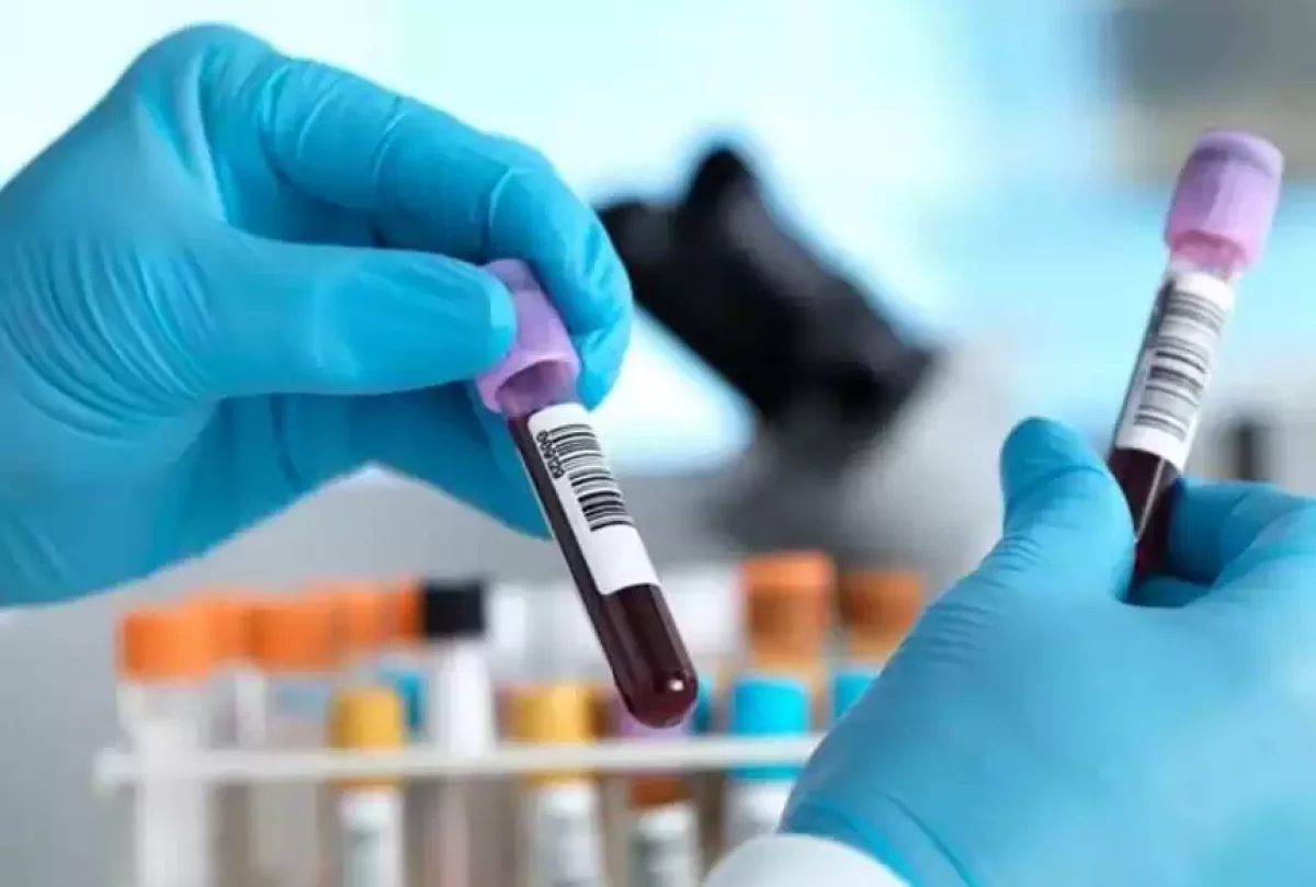 Британ ғалымдары қан талдауы арқылы қатерлі ісікті анықтаудың жаңа әдісін ойлап тапты