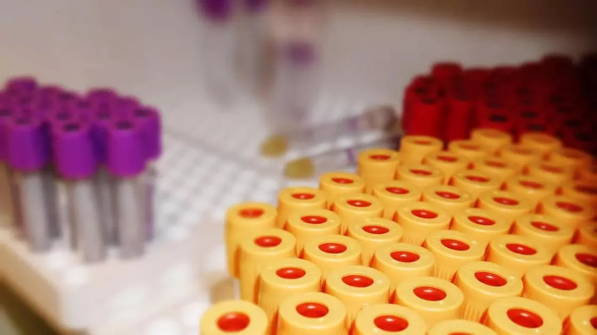 "Жұқтырған әрбір үшінші адам қайтыс болады": туберкулездің жасанды штамы пайда болғаны рас па?