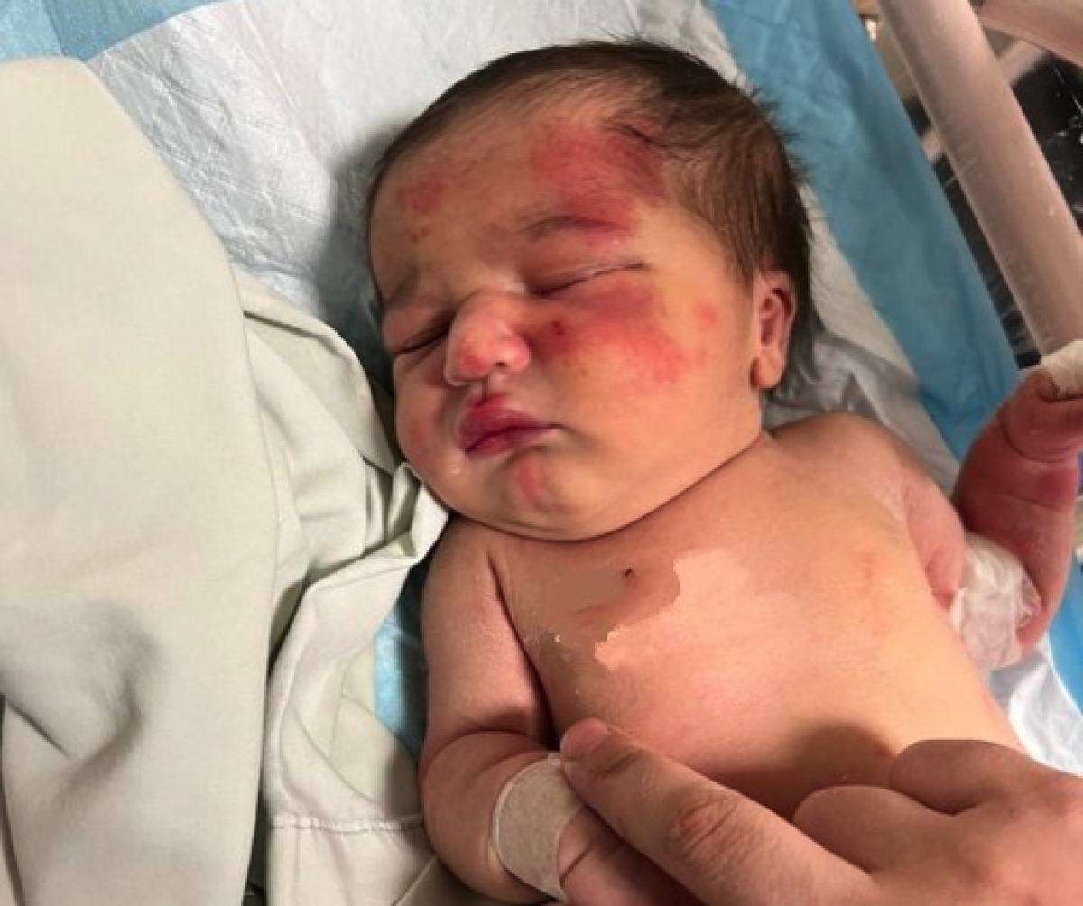 Ливанда қаңғыбас ит қоқыста жылап жатқан тастанды сәбиді құтқарды