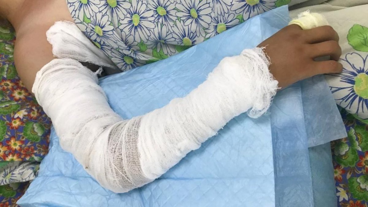 Ребенок попал в реанимацию после укуса змеи в Костанае