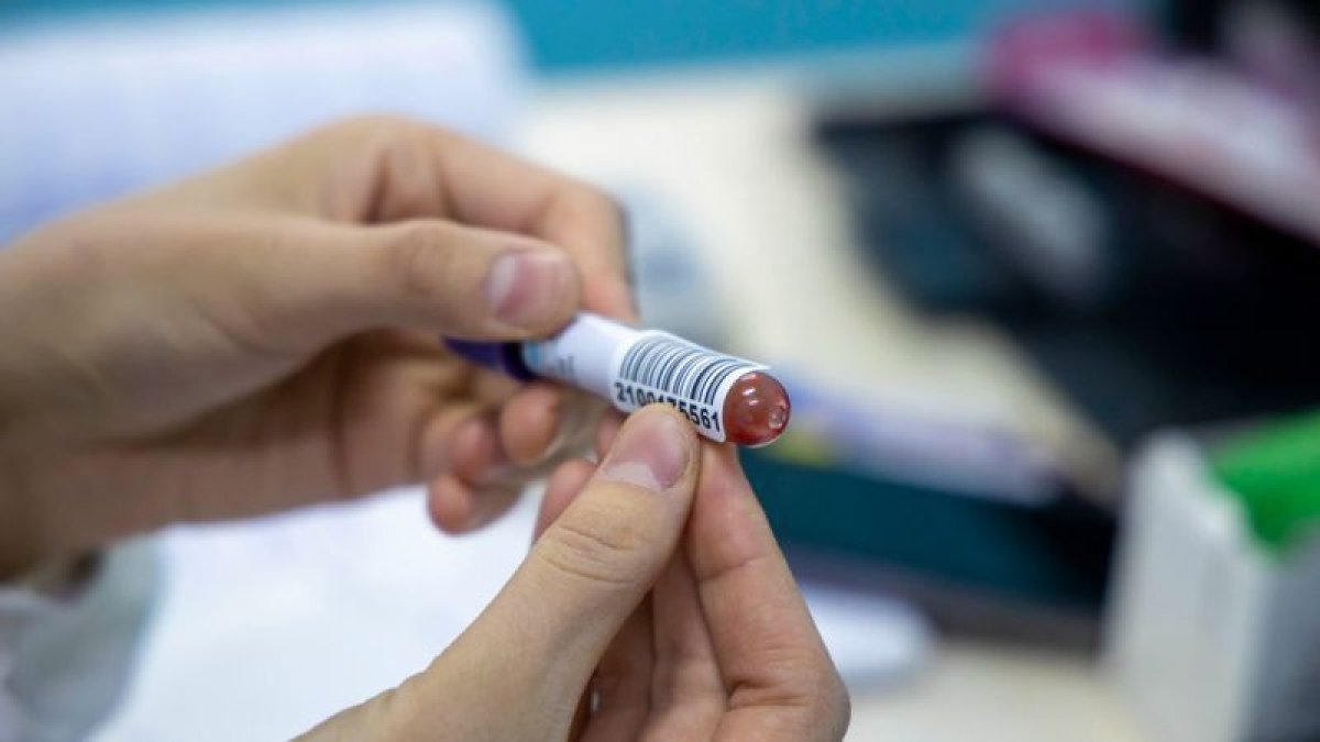 Тамақтан жаппай улану оқиғасы: Дәмхананың алты қызметкерінен сары стафилококк анықталды