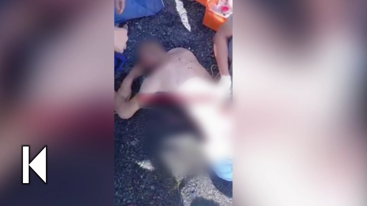 Алакөлге демалуға барған ер кісі аяғынан айырылды