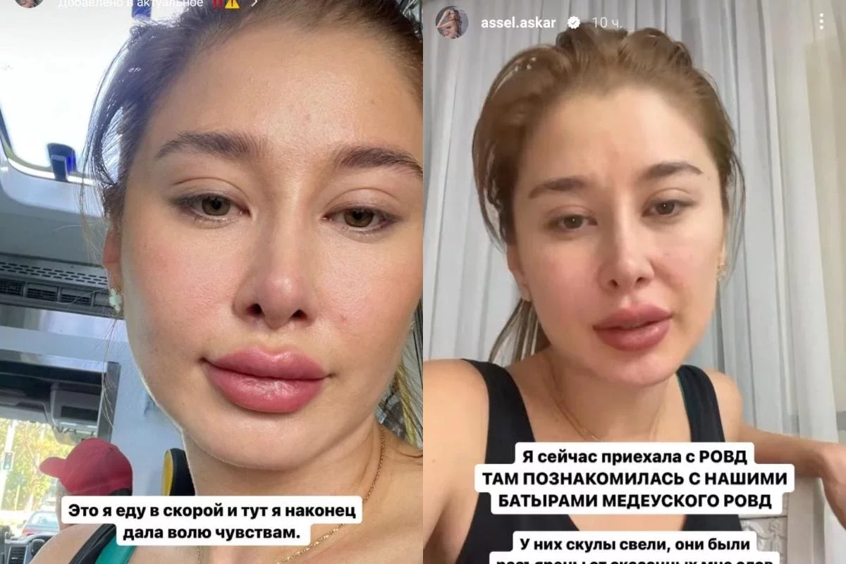 "Үш рет ұрды, балағаттады": Блогер Әсел Асқар спортшының өзіне шабуыл жасағанын айтты