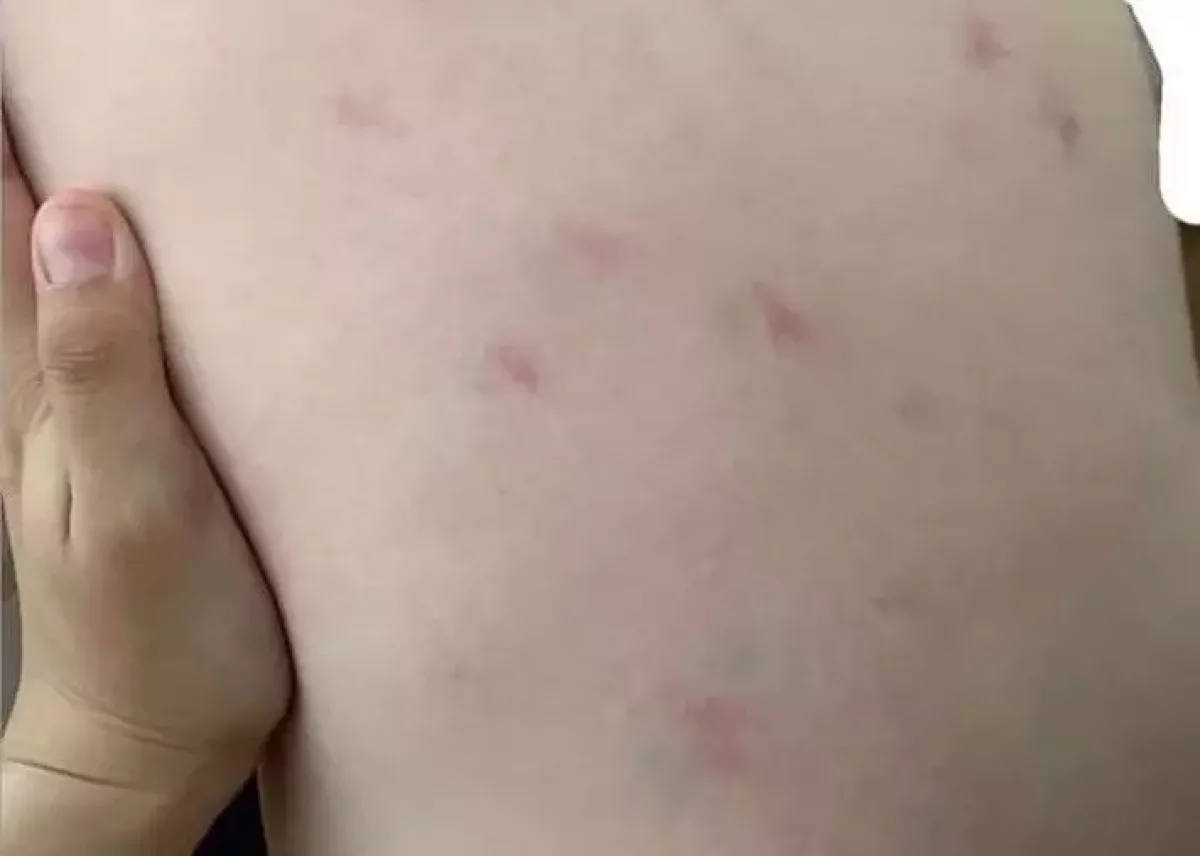 "Ешкім де ештеңені мойындағысы келмейді". Атыраулық бүлдіршін балабақшада жарақат алды