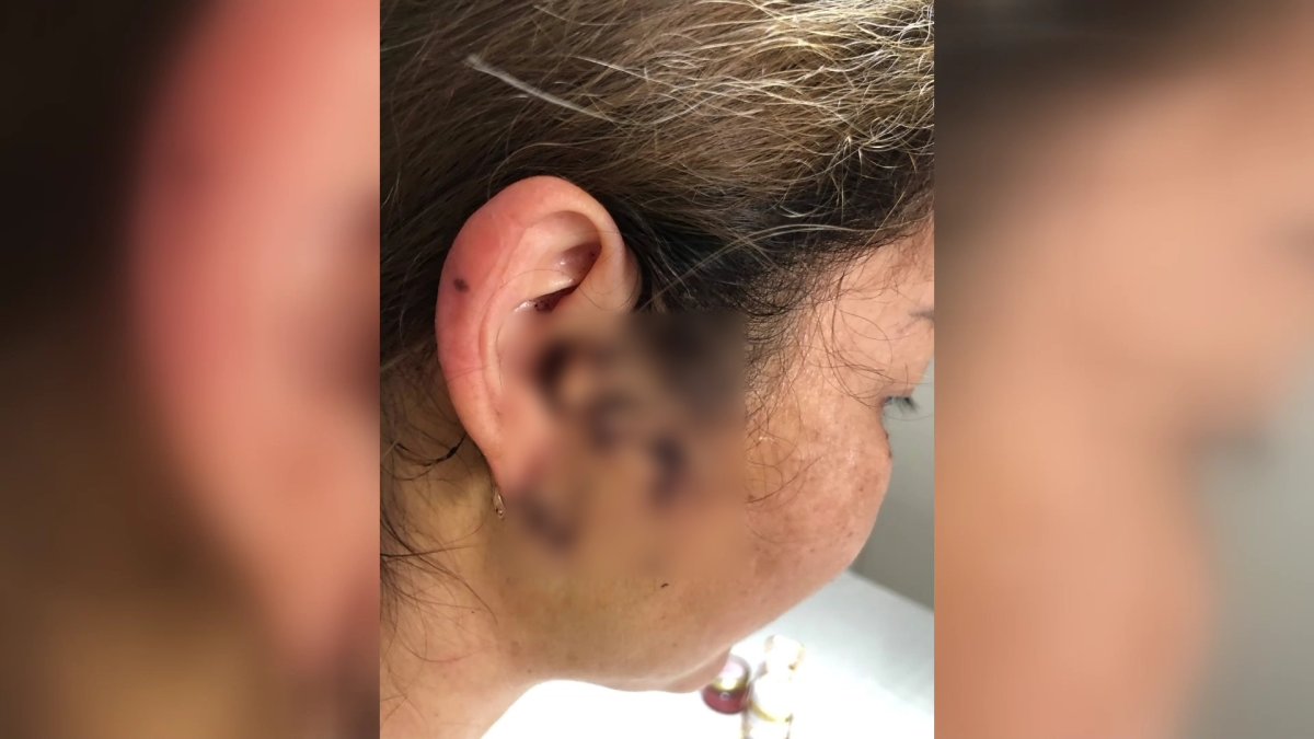 Пять ножевых ранений: появились новые подробности попытки изнасилования в Аксае