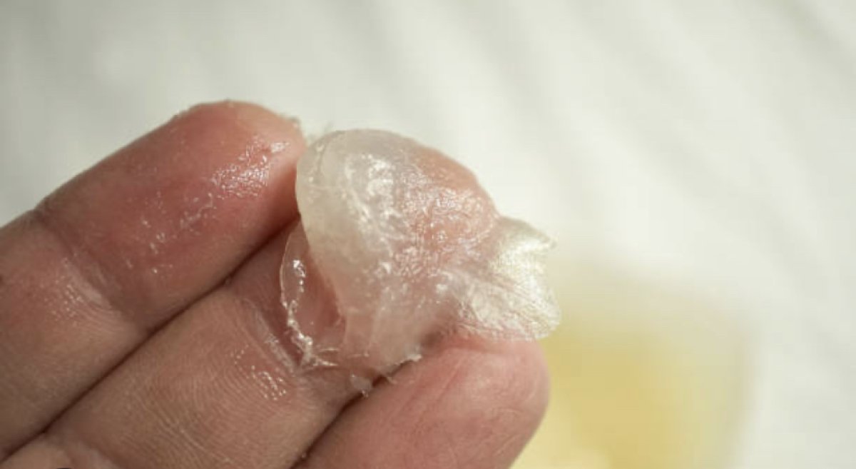 Омич пытался увеличить половой орган вазелином и чуть не умер