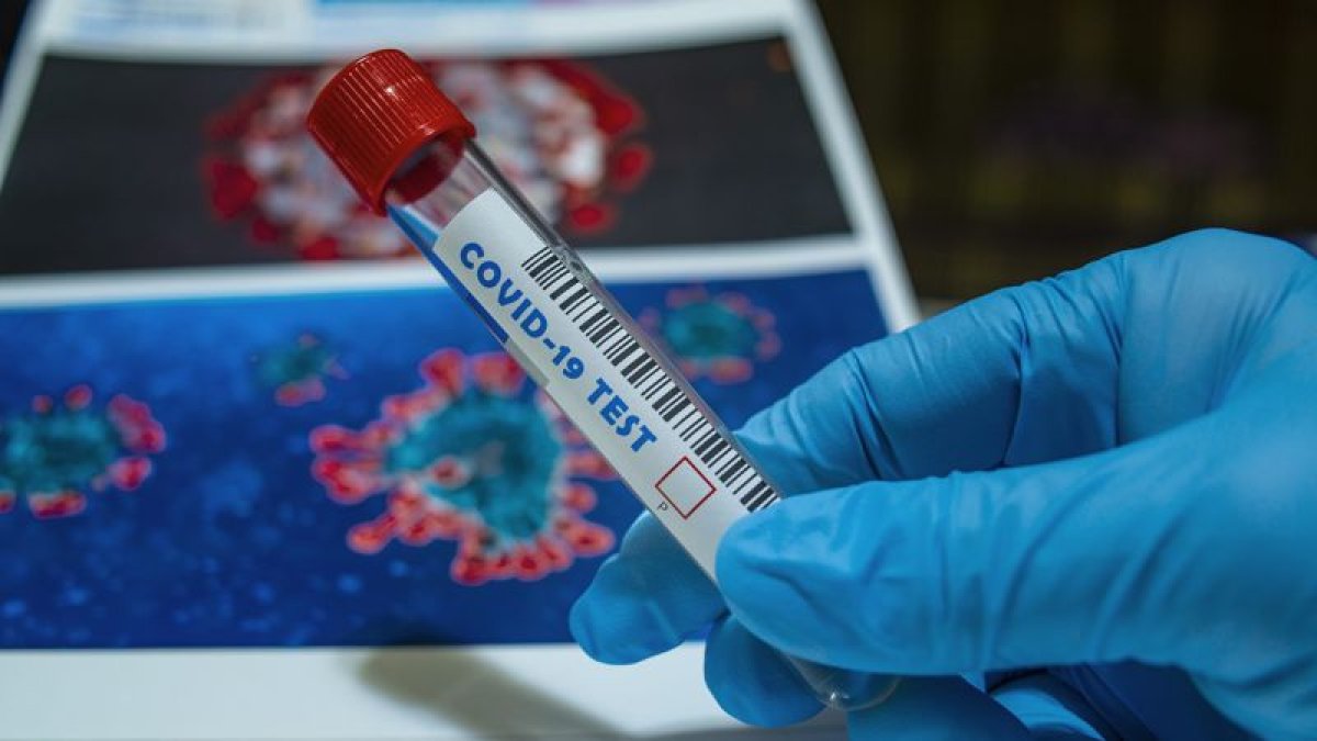 Дәрігер COVID-19 "Пирола" жаңа штаммының негізгі белгілерін атады
