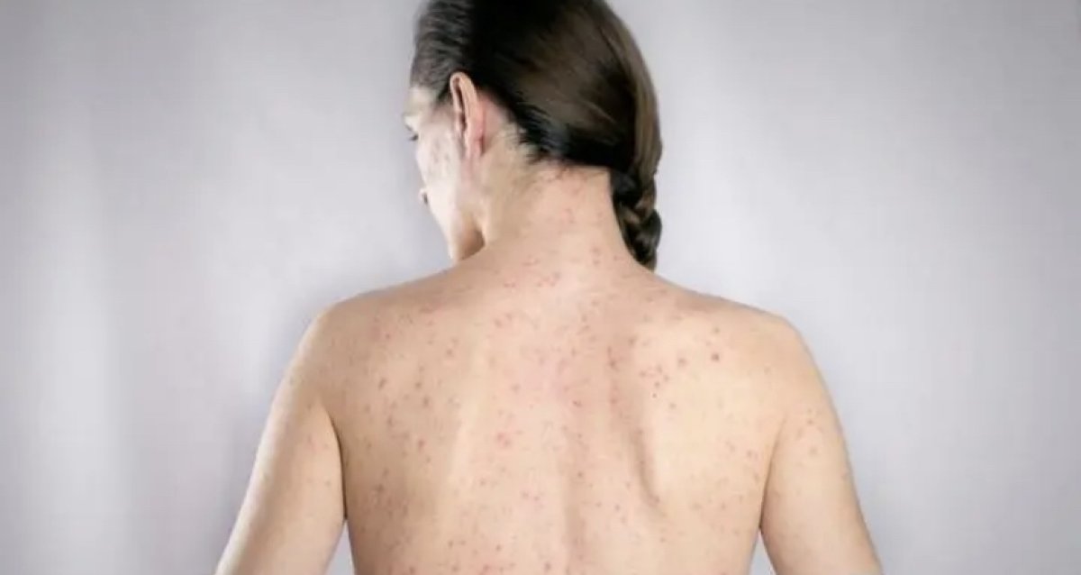 Мужчина умышленно заражал женщин ВИЧ в Карагандинской области