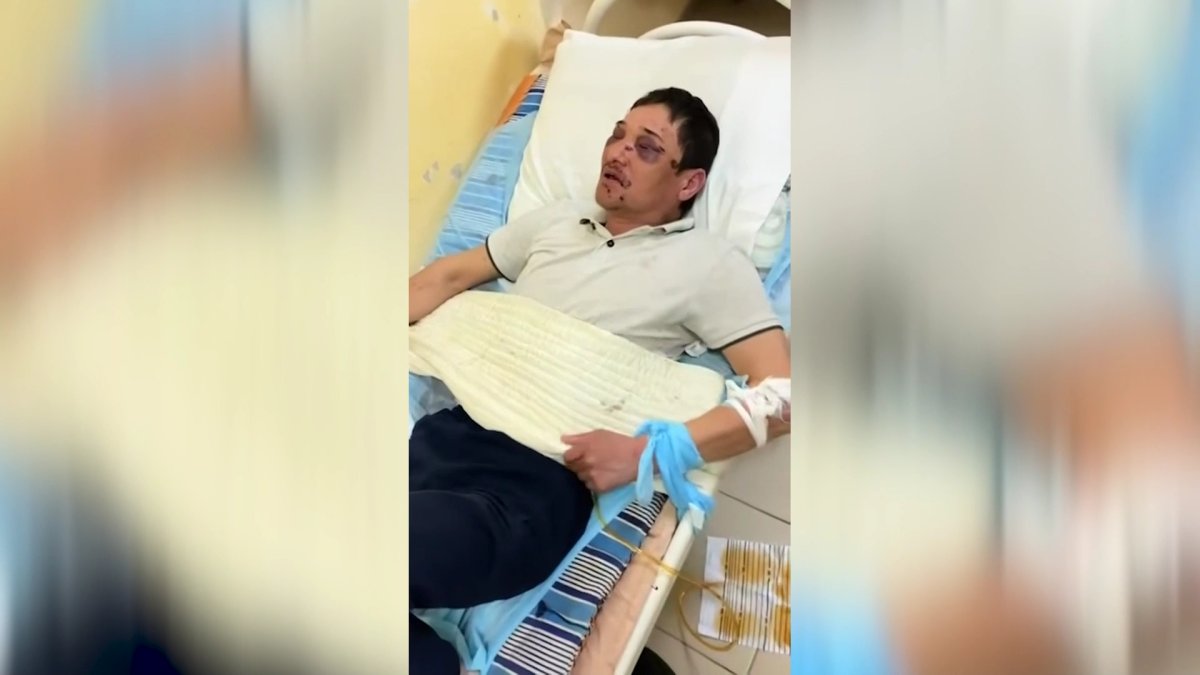Атыраулық азаматты аямай соққыға жығып, мүгедек қылғандар бостандықта жүр