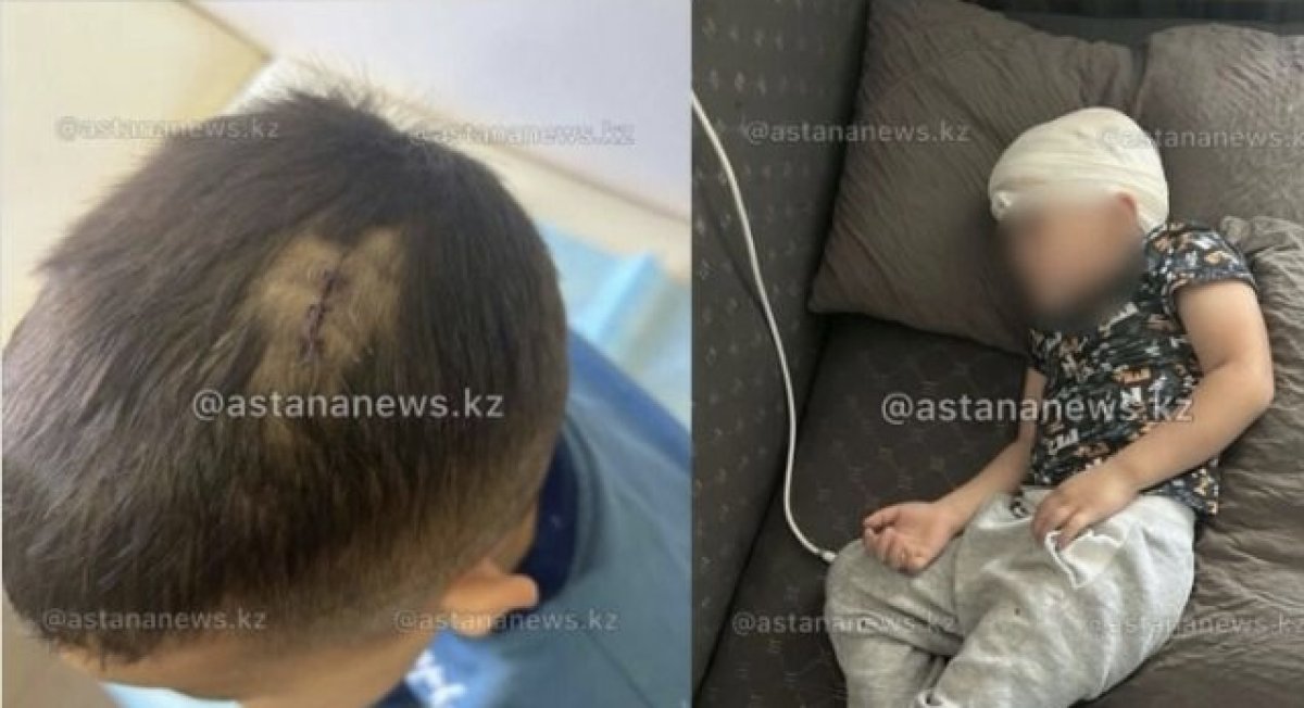 Ребёнка ударили стулом по голове: полиция Астаны начала проверку