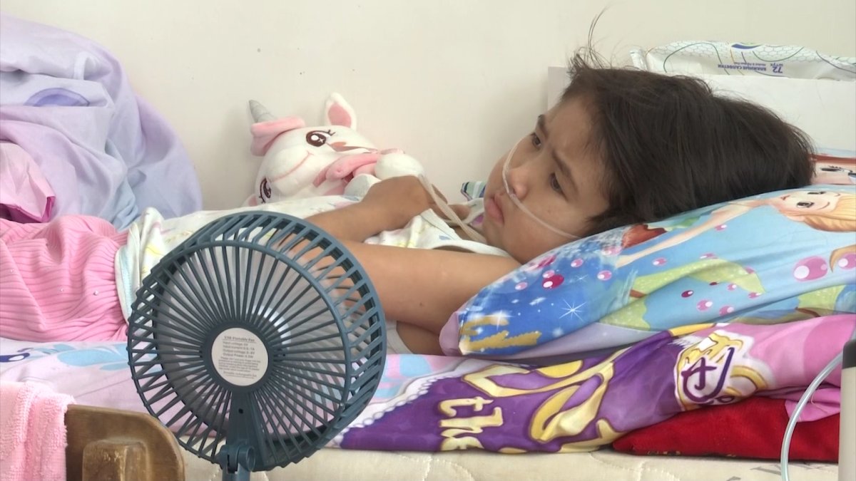 Түркістандық  9 жасар Сезімгүлді Үндістанда емдету үшін  көмек керек