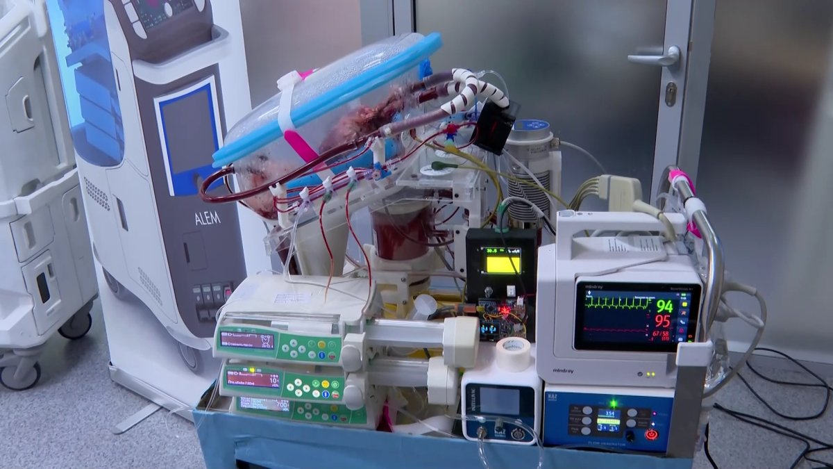 Қазақстандық дәрігерлер адам ағзасын сақтайтын құрылғы жасауда