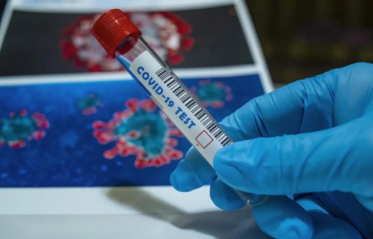 Алматыда коронавирус жұқтырғандар саны артып келеді