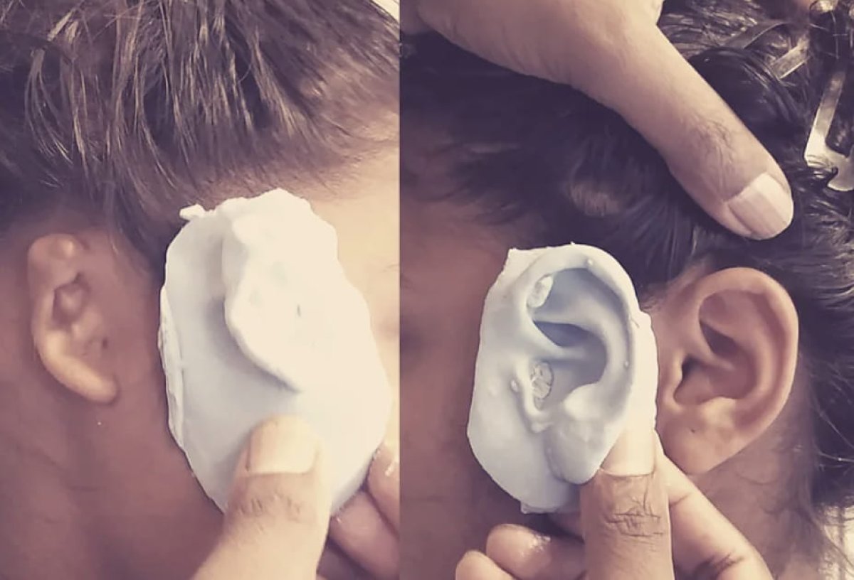 Принести на операцию свои инструменты предложили пациенту из Атырау