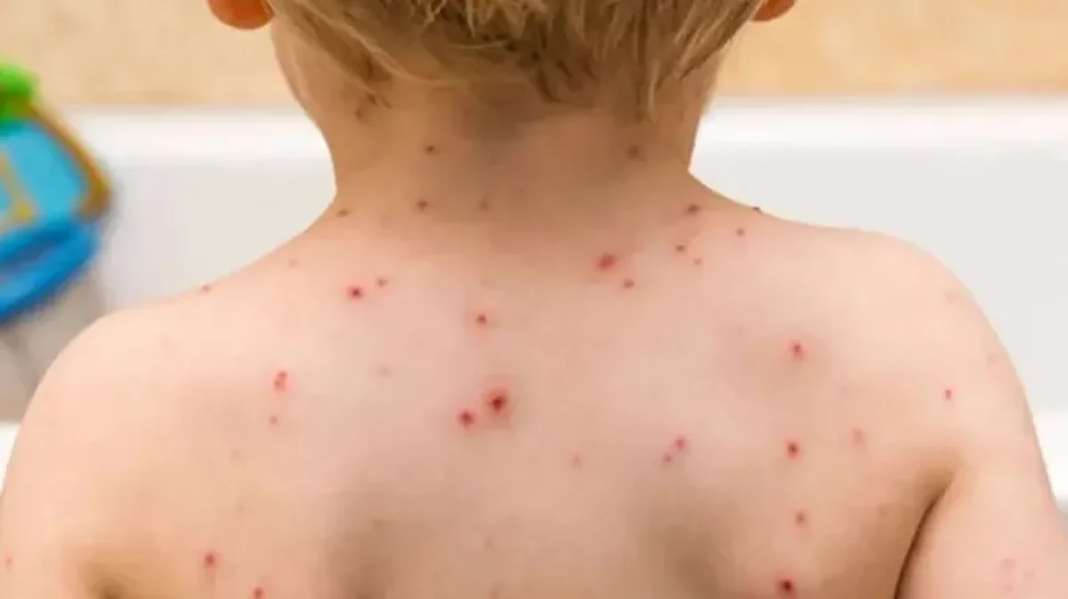 Қызылшадан 7 адам қайтыс болды