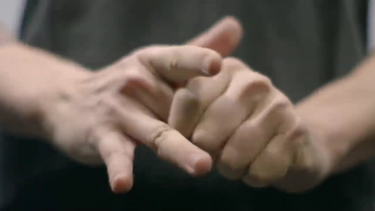 "Буын сықырлату жеке ауру тудырмайды", - дәрігер жауабы