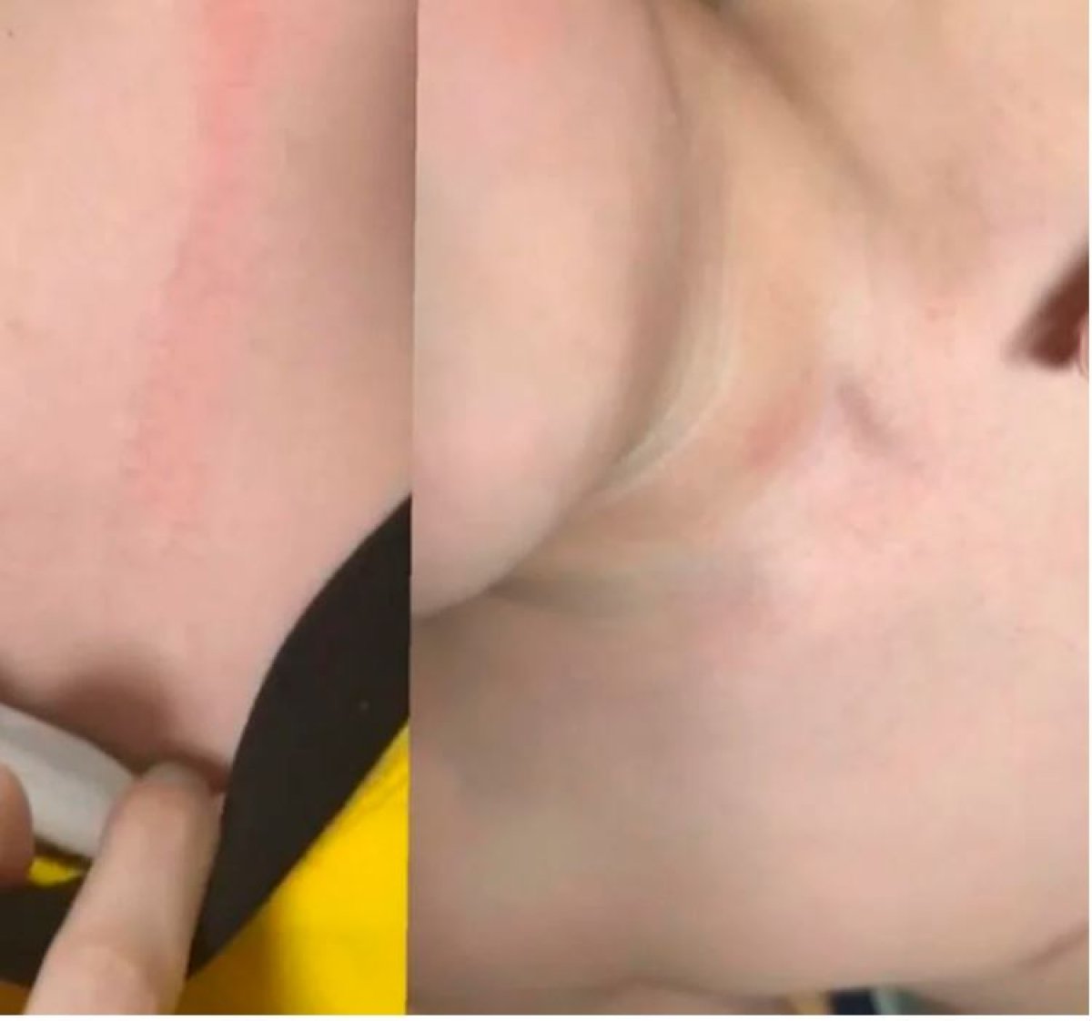 В Алматы родитель чуть не задушил одноклассника своего сына в отместку за драку мальчишек