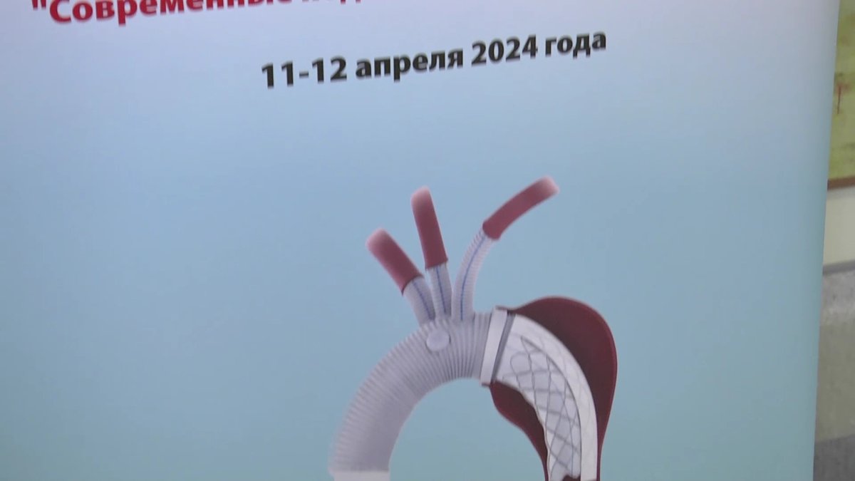 «Замороженный хобот слона» установили 63-летнему павлодарцу