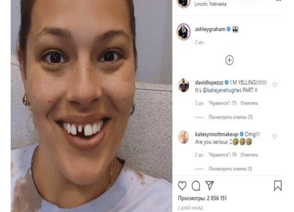 Тіс өсіретін дәрі адамдарға сынала бастады