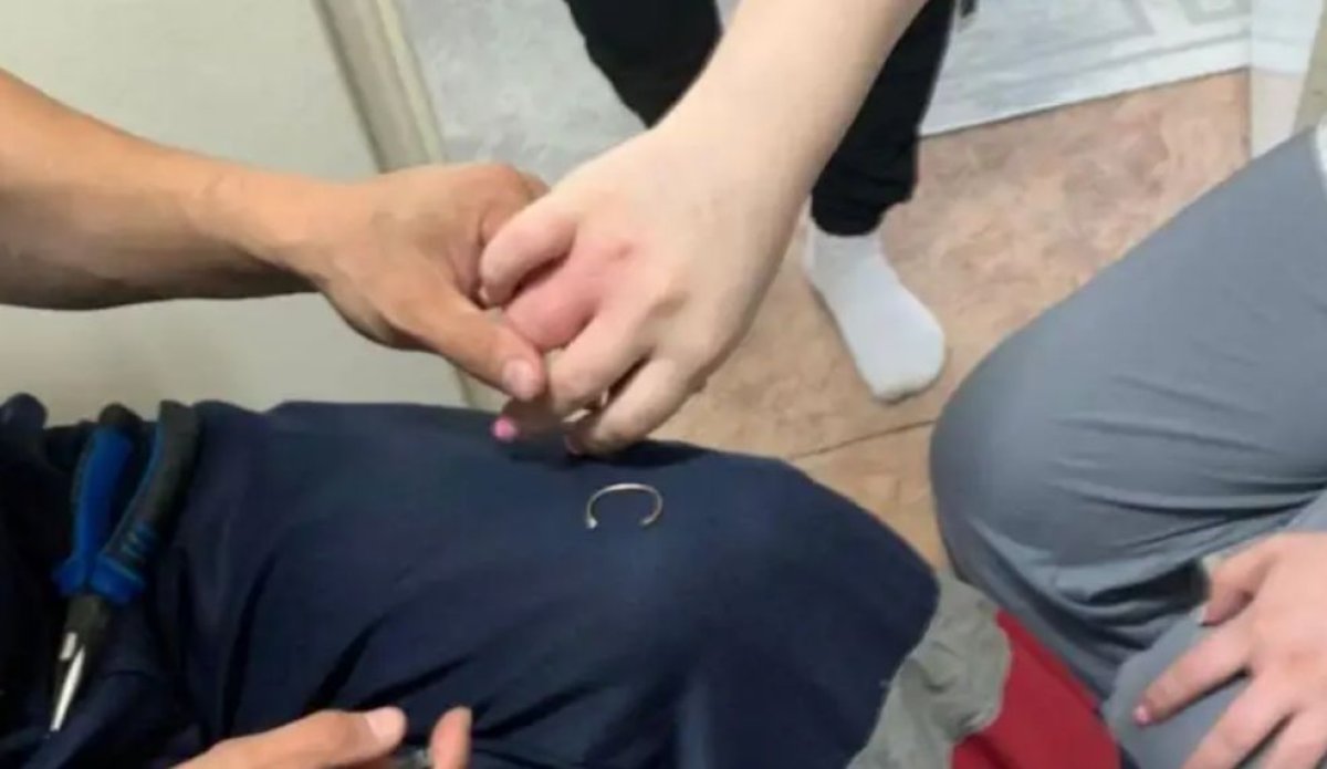 Өскемендік әйел саусағынан сақинаны шеше алмай, әбден қиналған