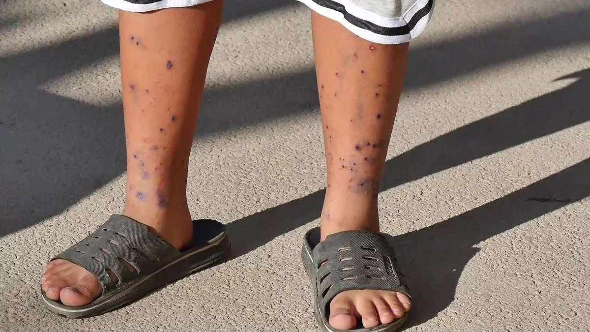 Ақтау қаласында бүрге қаптап кетті