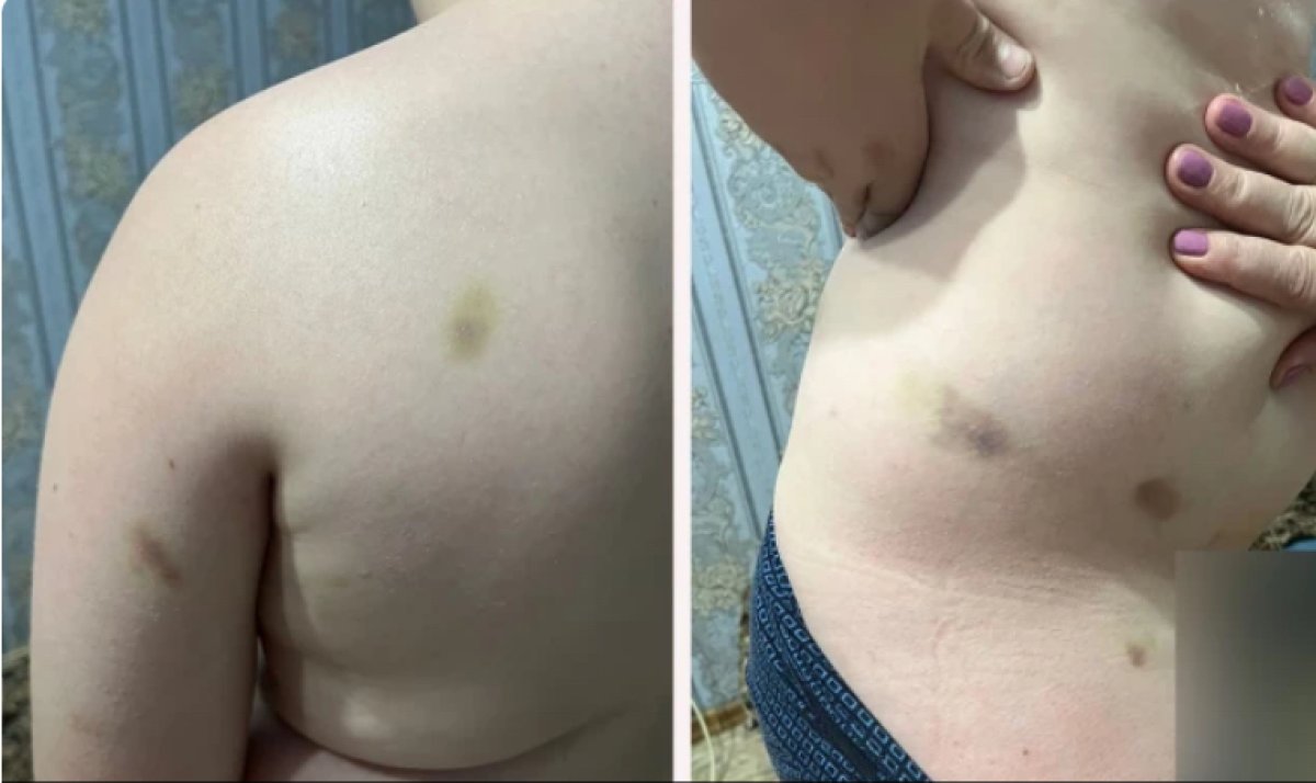 10-летнего ребёнка избили в детском лагере Уральска
