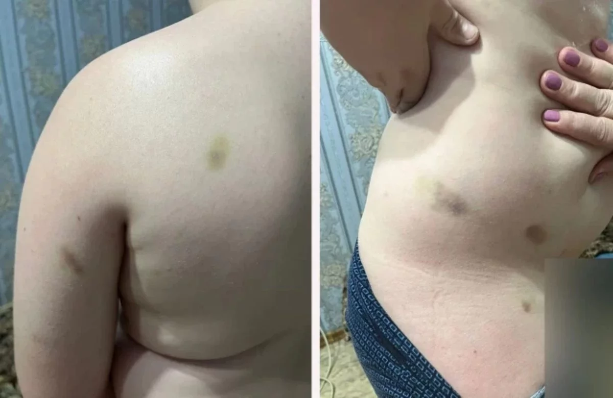 Оралда лагерьде 10 жастағы баланы соққыға жыққан: Директор жұмыстан қуылды