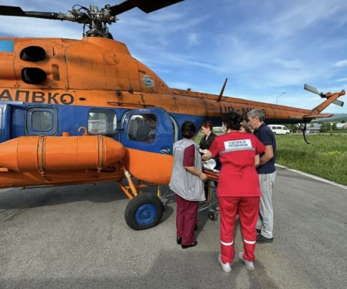 Беременную с 70% ожогов спасли врачи ВКО